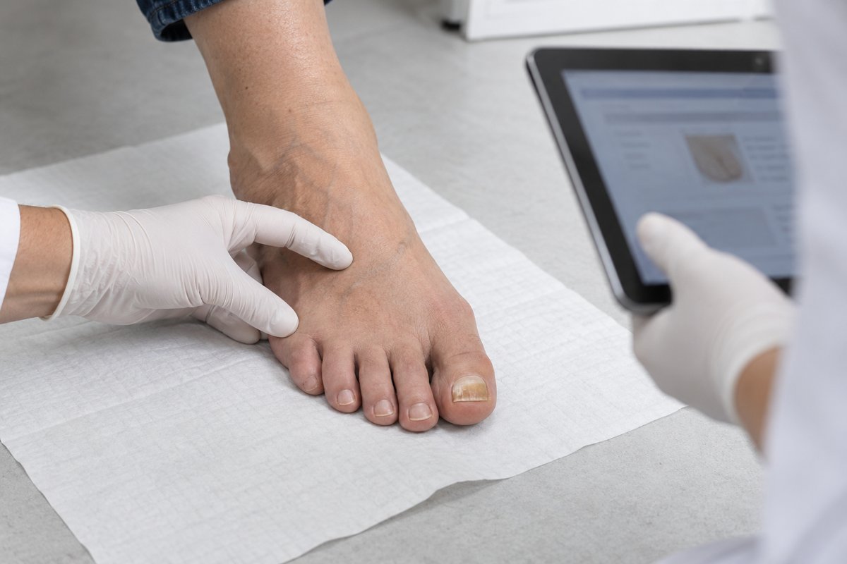 Illustration einer Nagelkontrolle und Dokumentation des Behandlungsverlaufs